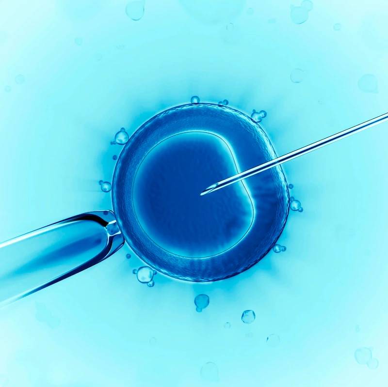 درخواست IVF تضمینی