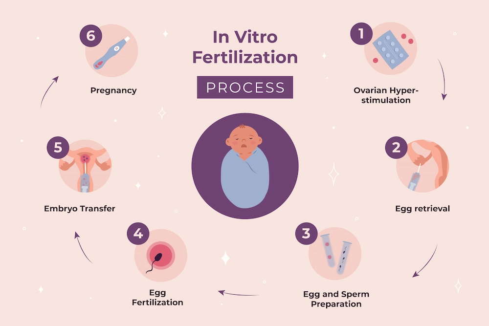 The IVF Process in Iran: A Step-by-Step Guide for Patients