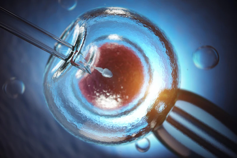 آی‌وی‌اف (IVF) چیست؟